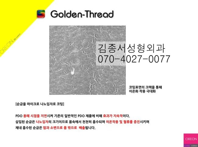 금실PDO매선 한국에서 세계최초 출시 / 김종서성형외과 금실-시술병원 선정 관련 이미지 8