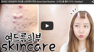 여드름 흉터관리 youtube 동영상에  레티나지 <골드스템 앰플> 과 셀퓨전씨 <리주버네이션 미스트> 제품이 소개^^ 관련 이미지 1