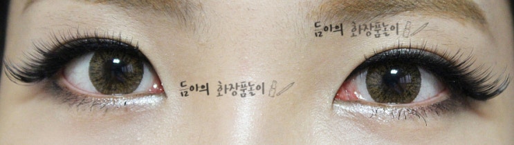[공유] 성형수술을 결심하게 된 계기. in 김종서 성형외과 관련 이미지 3