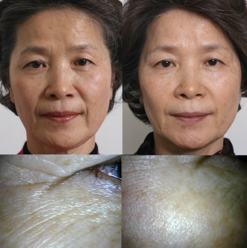 ANTI-AGING MEDICINE ASIAN CONGRESS (싱가폴 세계학회 발표/ 김종서성형외과원장 10월 25-27일 무려 3개 강의) 관련 이미지 4