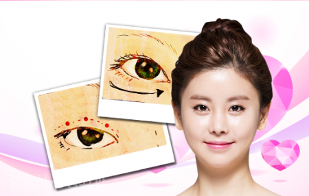 Detailed Eye Plastic Surgery Information! image 6