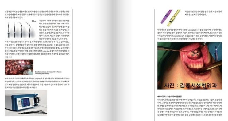 [메디컬 S] 메디컬s 2월호에 소개된 초음파치료 (울쎄라, 울트라포머) / 김종서성형외과 관련 이미지 3