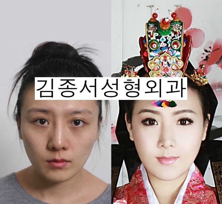 중국분인데요..광대수술을 하시고 한복을 입고 사진을 보내주셨네요 ^^ 관련 이미지 2