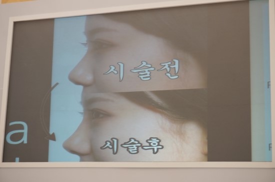 I Went to the Restylane 20 Million Treatment Commemoration Beauty Week image 23