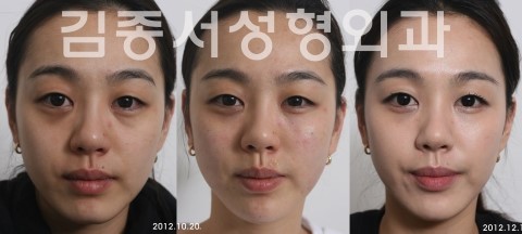ANTI-AGING MEDICINE ASIAN CONGRESS (싱가폴 세계학회 발표/ 김종서성형외과원장 10월 25-27일 무려 3개 강의) 관련 이미지 3