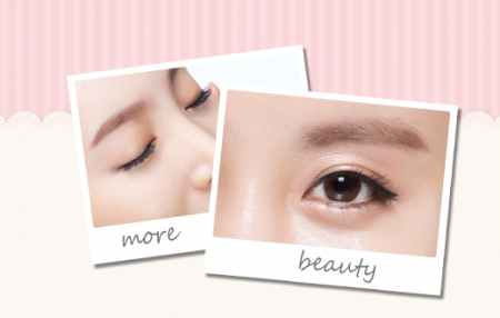 Debunking Eye Plastic Surgery Information! image 7
