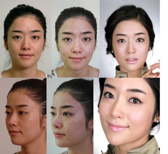 촉촉피부 물광주사! 관련 이미지 5