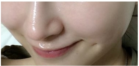 물광주사 잘하는곳 관련 이미지 1