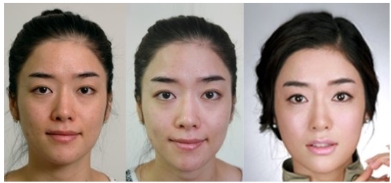 물광주사 잘하는곳 관련 이미지 4