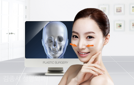 ◆Information Sharing◆ Rhinoplasty image 4