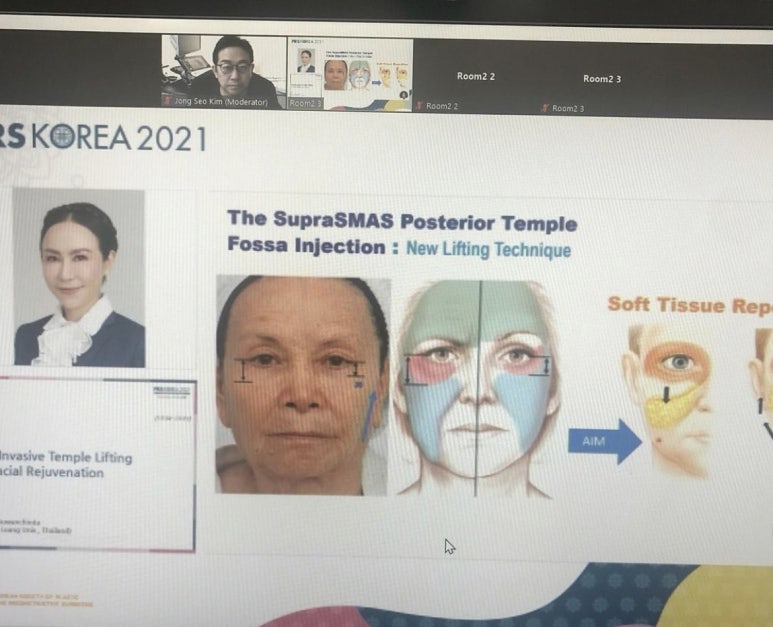 2021년 11월 14일  대한성형외과 학회 보톡스/필러/실리프팅 분야를 맡은 김종서성형외과 관련 이미지 13