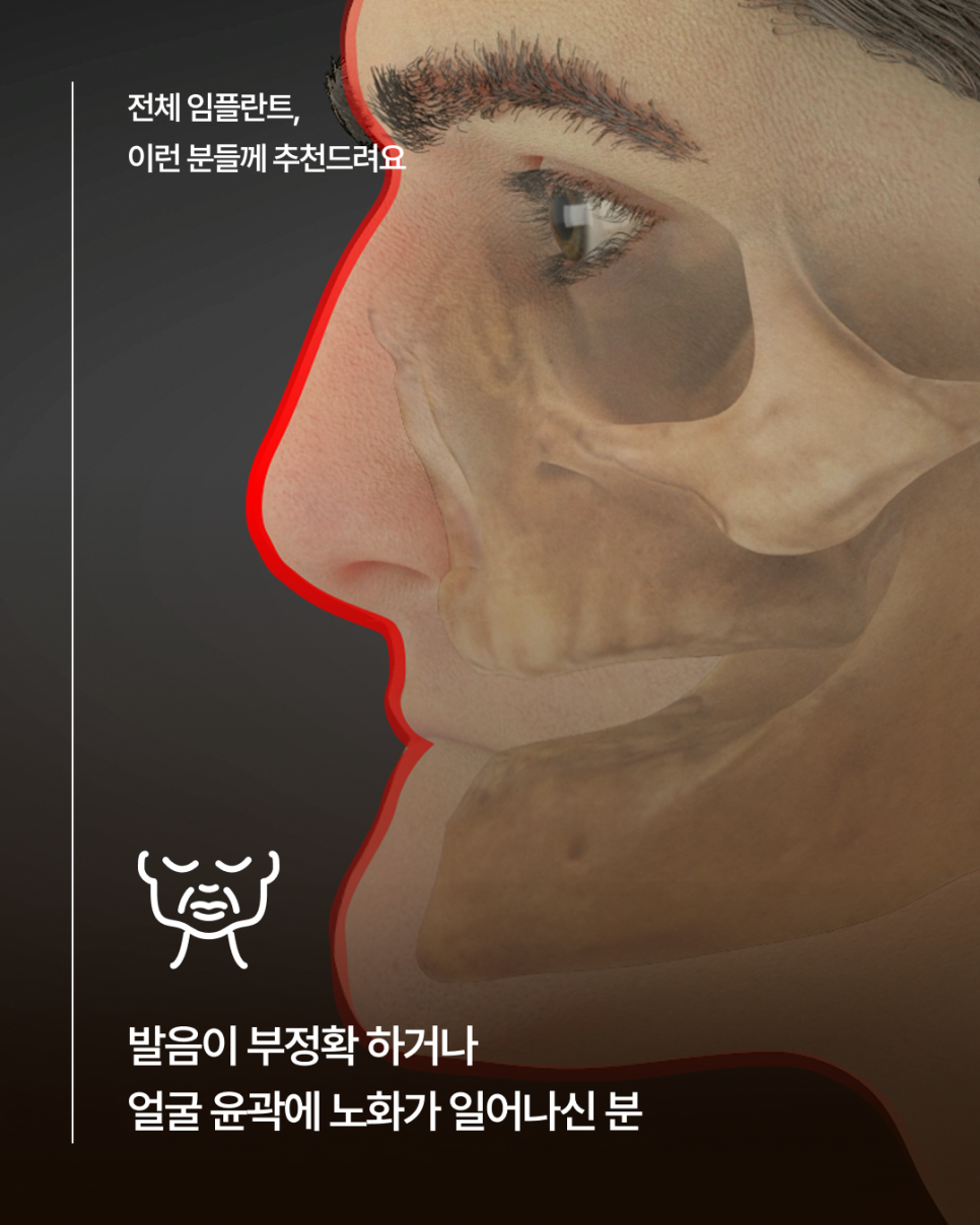 65세이상임플란트 중 무치악에 해당한다면, 전체임플란트가 필요한지 먼저 확인하세요! 관련 이미지 6