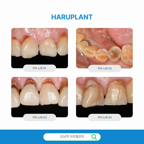 하루완성 하루네이트, 네 가지 핵심 가치 관련 이미지 2