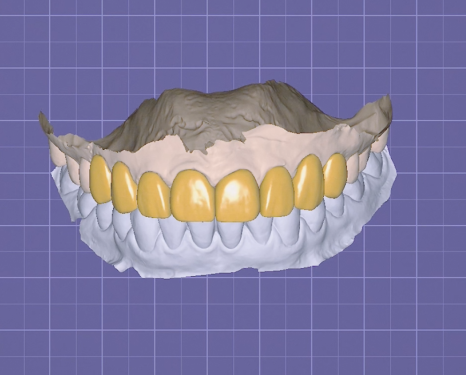 강남역하루플란트치과 하루네이트 라이브, 세계가 주목한 임상 현장의 기록 관련 이미지 7