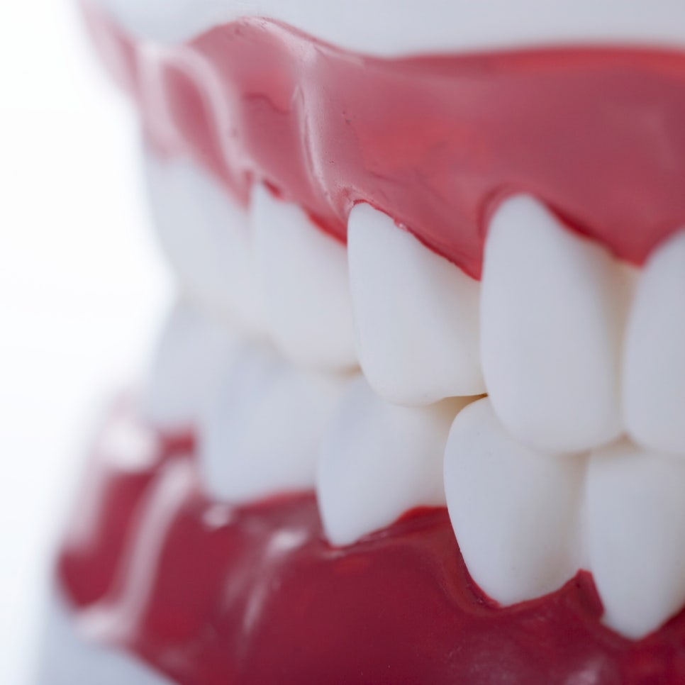 틀니가 불편했다면? 임플란트와의 차이를 확인해보세요! 임플란트 치료 전 꼭 봐야 할 차이 관련 이미지 2