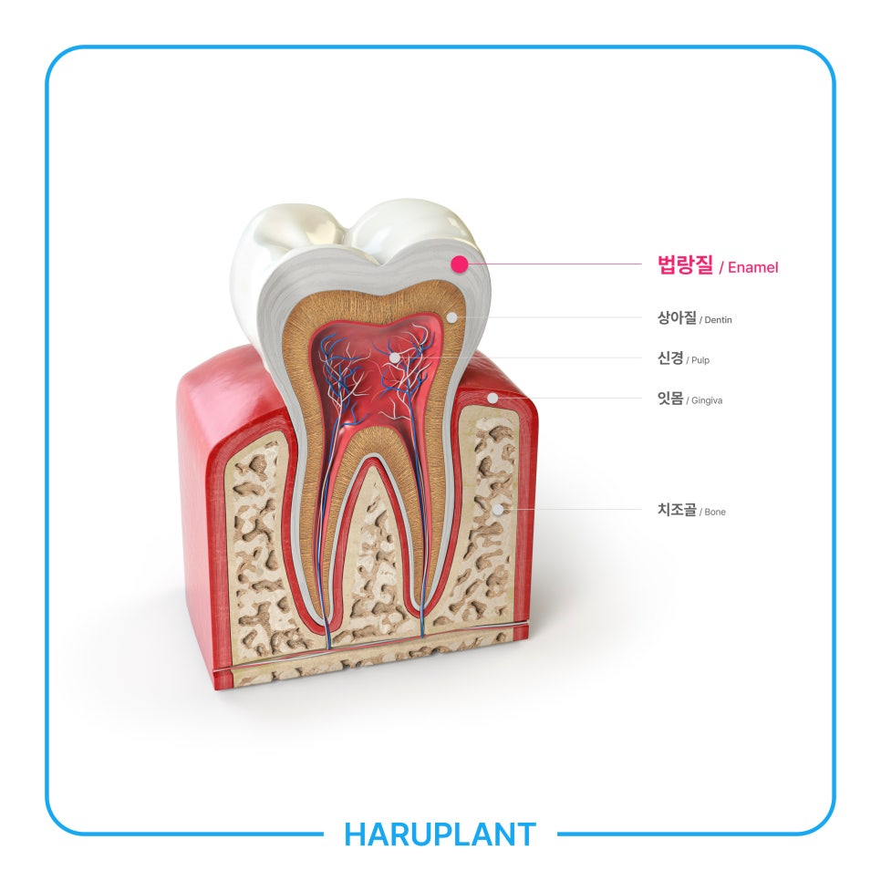 이 시린 이유, 시린 이 치료법 하루네이트로 회복하세요 관련 이미지 2