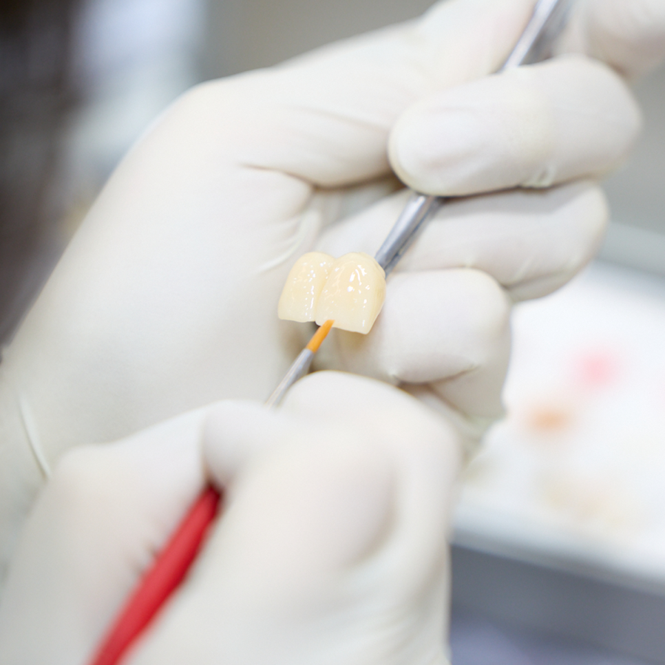 앞니 임플란트 고민 중이라면? 하루플란트와 함께 체크해야 할 사항, 세 가지 알아보기 관련 이미지 5