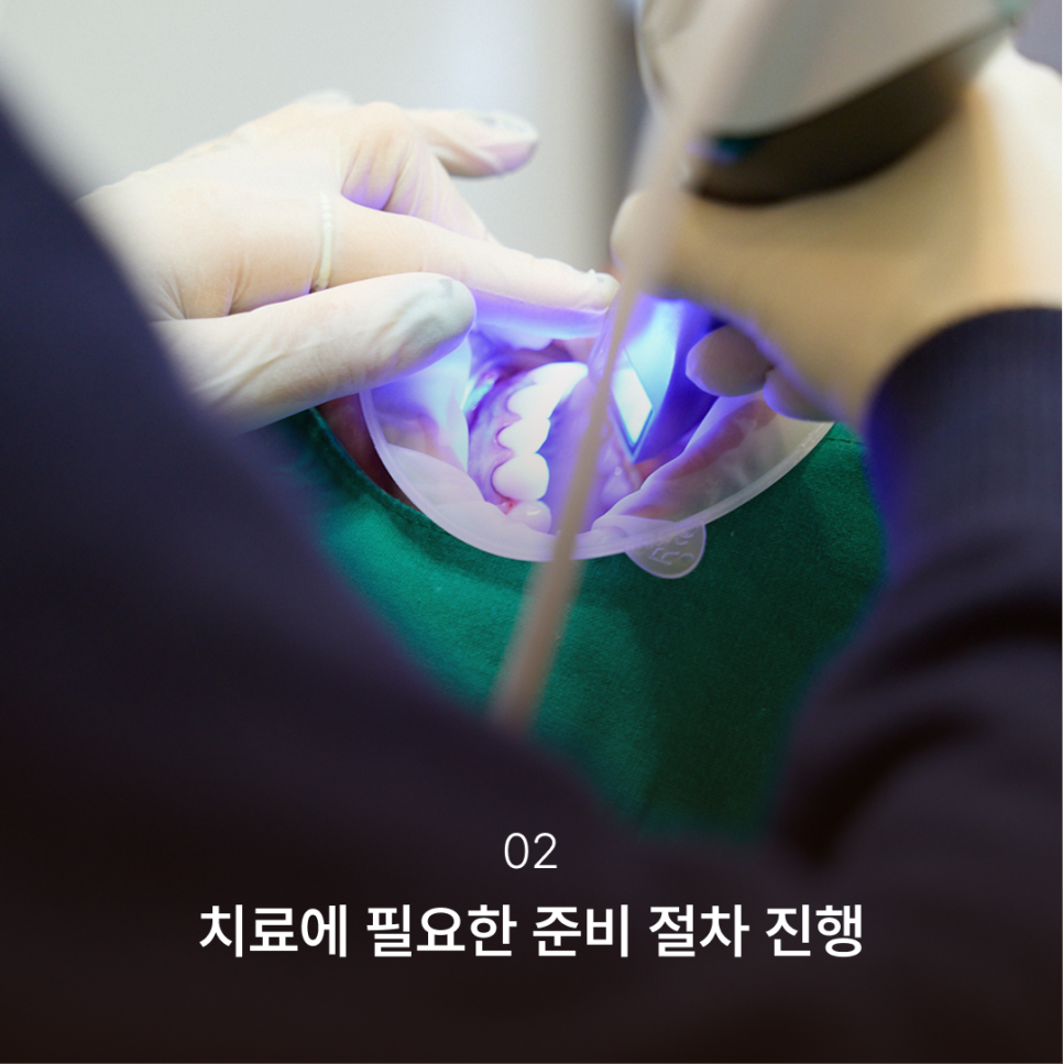 Why the Implant Impression Process Has Changed: The Full Implant Treatment Process at Haru Implant Dental Clinic at Gangnam Station That Makes a Difference in Results image 3