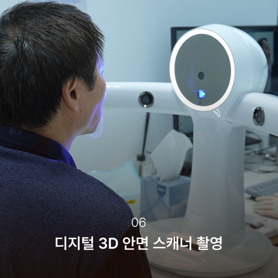 Why the Implant Impression Process Has Changed: The Full Implant Treatment Process at Haru Implant Dental Clinic at Gangnam Station That Makes a Difference in Results image 7