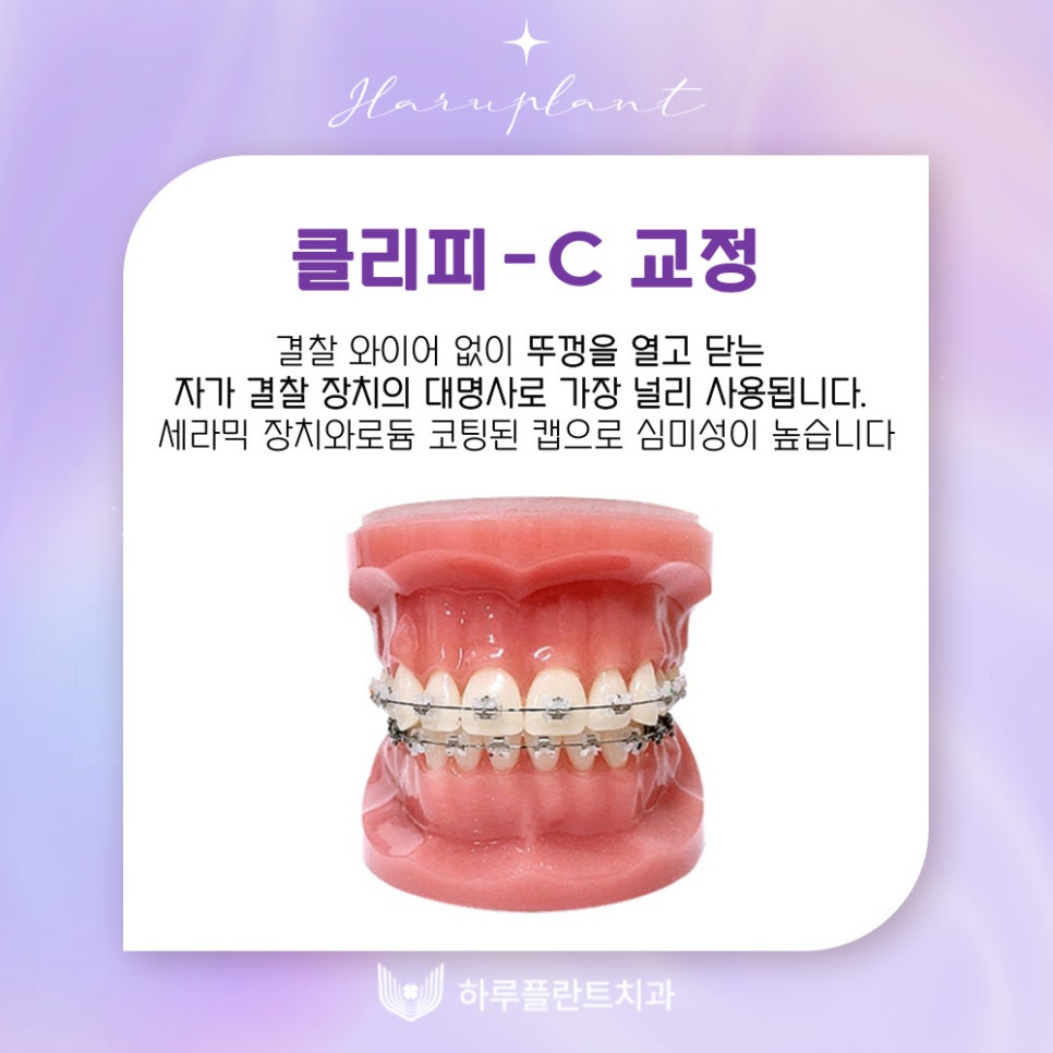 강남역치과 하루플란트치과 치아교정 개인별 맞춤 교정으로 관련 이미지 10