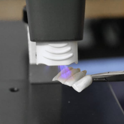 플라즈마 임플란트, 정말 믿고 선택해도 되는 걸까? 관련 이미지 2