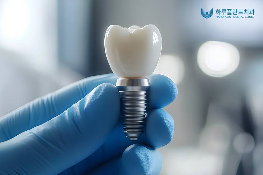 전악 임플란트 비용, 저희는 이 3가지로 비용을 줄였습니다. 관련 이미지 3
