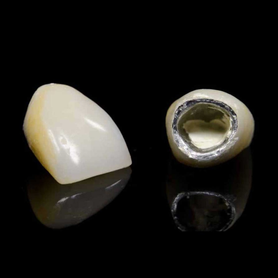 Zirconia Covered Too Now? Dental Insurance Benefits You Can Enjoy Starting in February! image 3