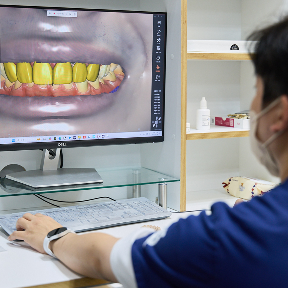 앞니 임플란트 고민 중이라면? 하루플란트와 함께 체크해야 할 사항, 세 가지 알아보기 관련 이미지 9