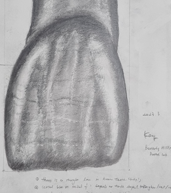 무삭제 라미네이트, 원데이 치료 관련 당부의 말씀 - 하루플란트치과 방문 전 필독 관련 이미지 10
