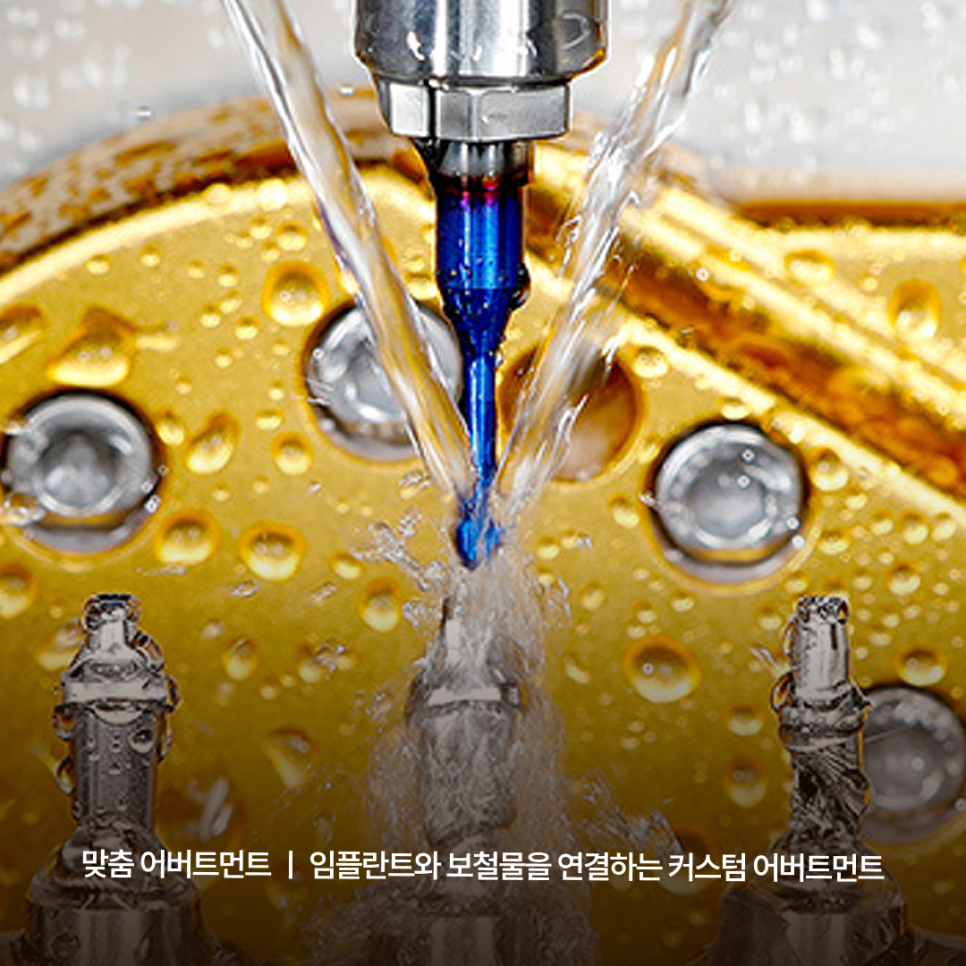 What to Look for When Choosing an Implant Dentist Near Gangnam Station—Find Out Through Haru Implant Dental Clinic’s Customized Care System image 6