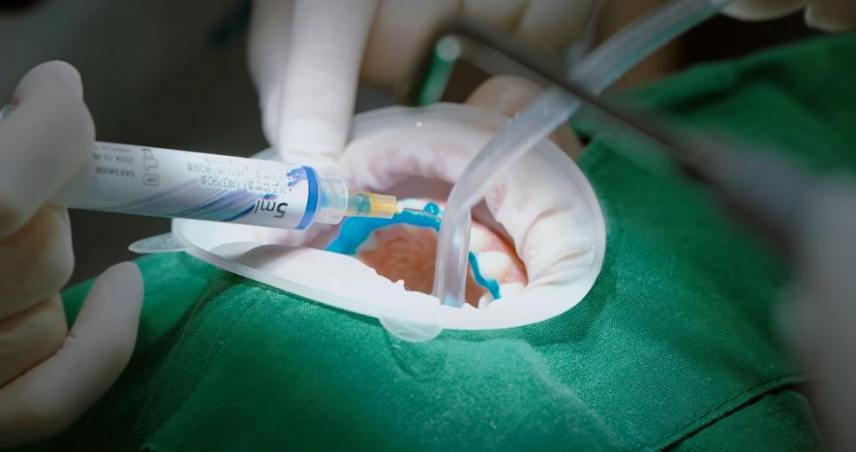 강남역하루플란트치과 하루네이트 라이브, 세계가 주목한 임상 현장의 기록 관련 이미지 9