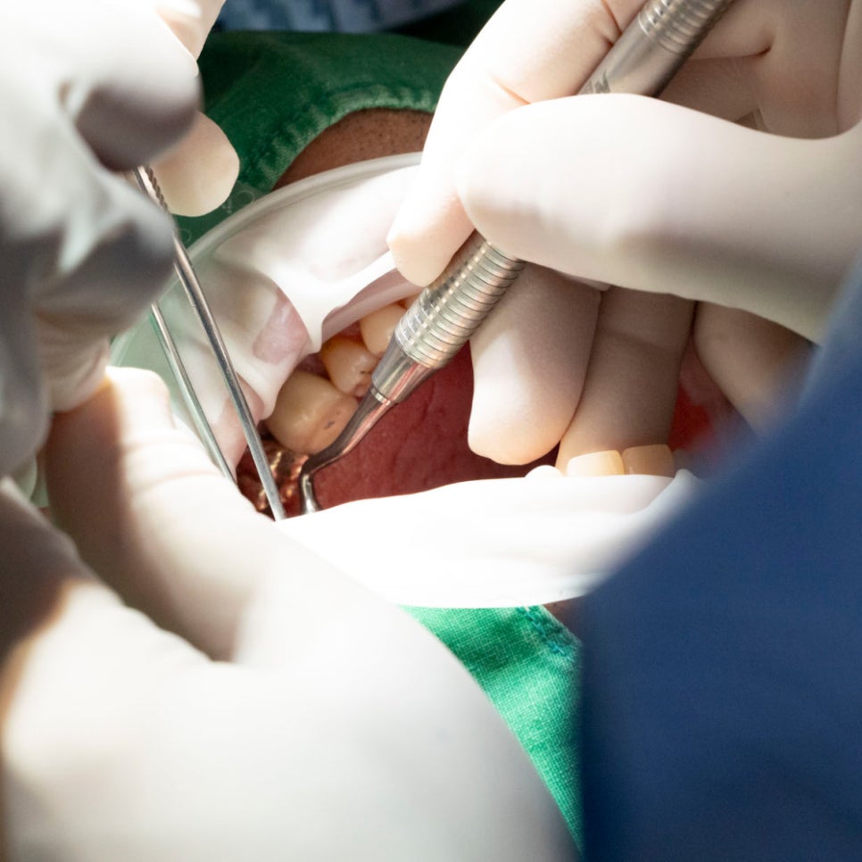 치과 감염관리, 어디까지 알고 계신가요? 하루플란트 플라즈마 멸균 시스템 전격 해부! 관련 이미지 4