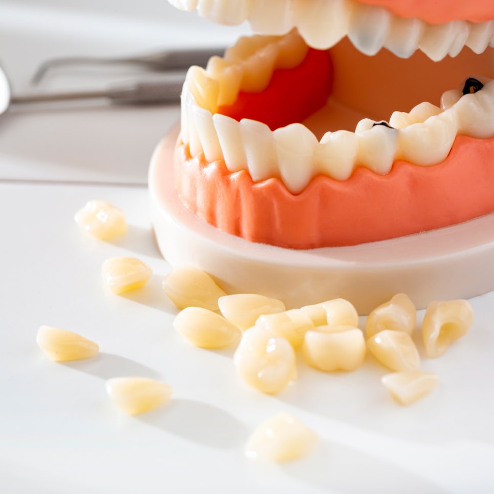 변색 치아, 단 하루면 충분하다? 하루플란트의 치아 미백 과정 전격 대공개! 관련 이미지 3