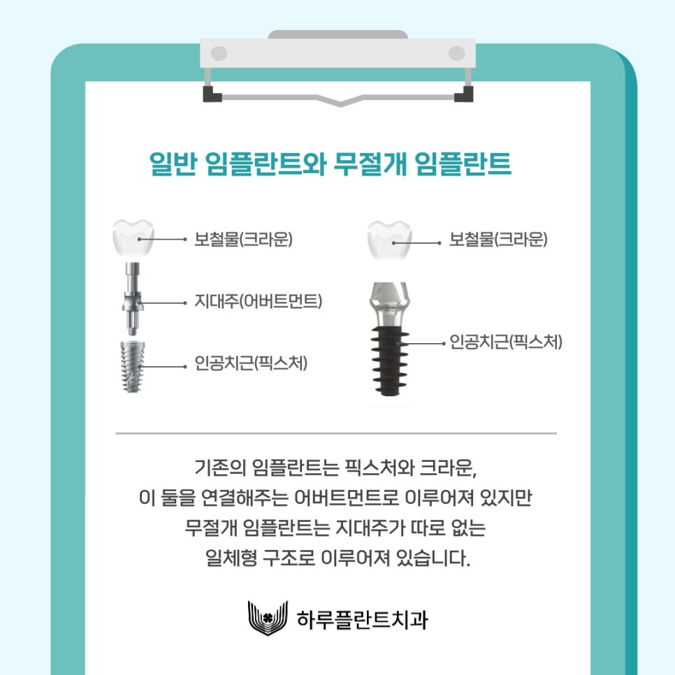임플란트 평생 쓸 수 있나요? 오래 쓰는 방법 대공개(무절개 임플란트 수명) 관련 이미지 2