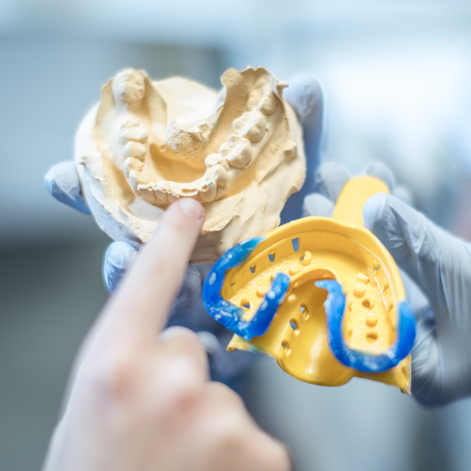 임플란트 이물감, 원인은 미세한 차이? 딱 맞는 보철물, 하루플란트에서 입 안 이물감 해결하기 관련 이미지 5