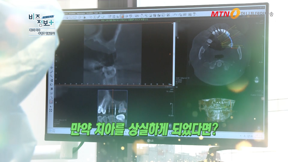 하루플란트치과 변성만 대표원장 MTN 신영일의 비즈정보 플러스 출연 관련 이미지 7