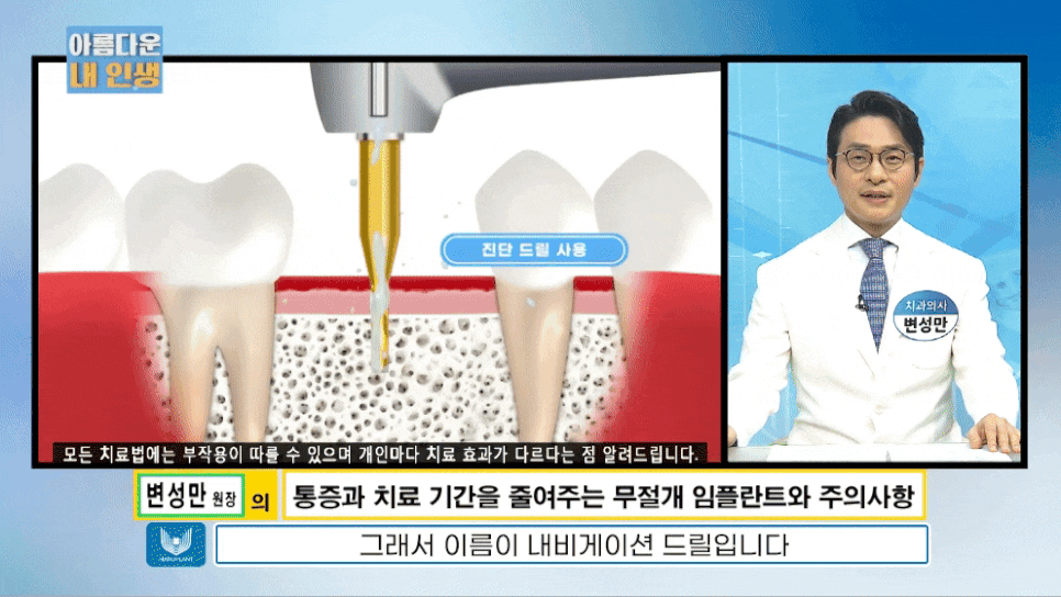 임플란트 전문가 변성만 원장 TV 출연 - 통증 줄인 무절개 임플란트 관련 이미지 10