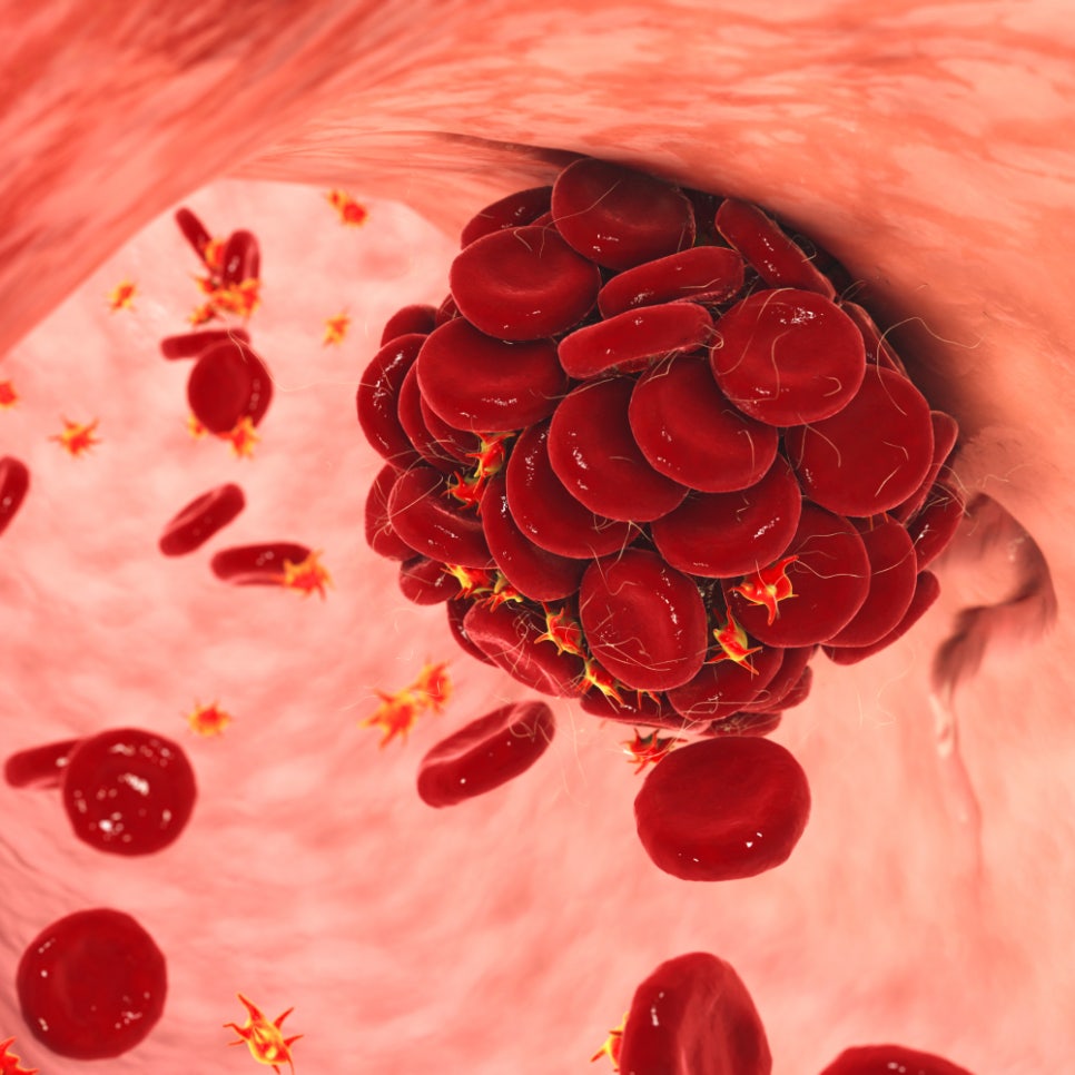 임플란트 후 가글, 해도 되는 거 맞죠? 하루플란트에서 알려드립니다! 관련 이미지 6