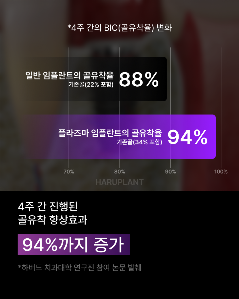 임플란트기간을 줄이고 싶다면? 빠른 회복으로 주목받는 플라즈마 임플란트, 후기까지 알아보세요! 관련 이미지 6