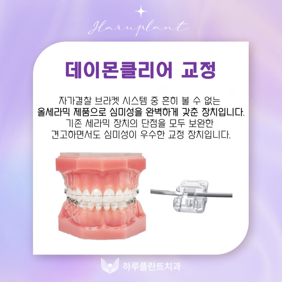 강남역치과 하루플란트치과 치아교정 개인별 맞춤 교정으로 관련 이미지 2