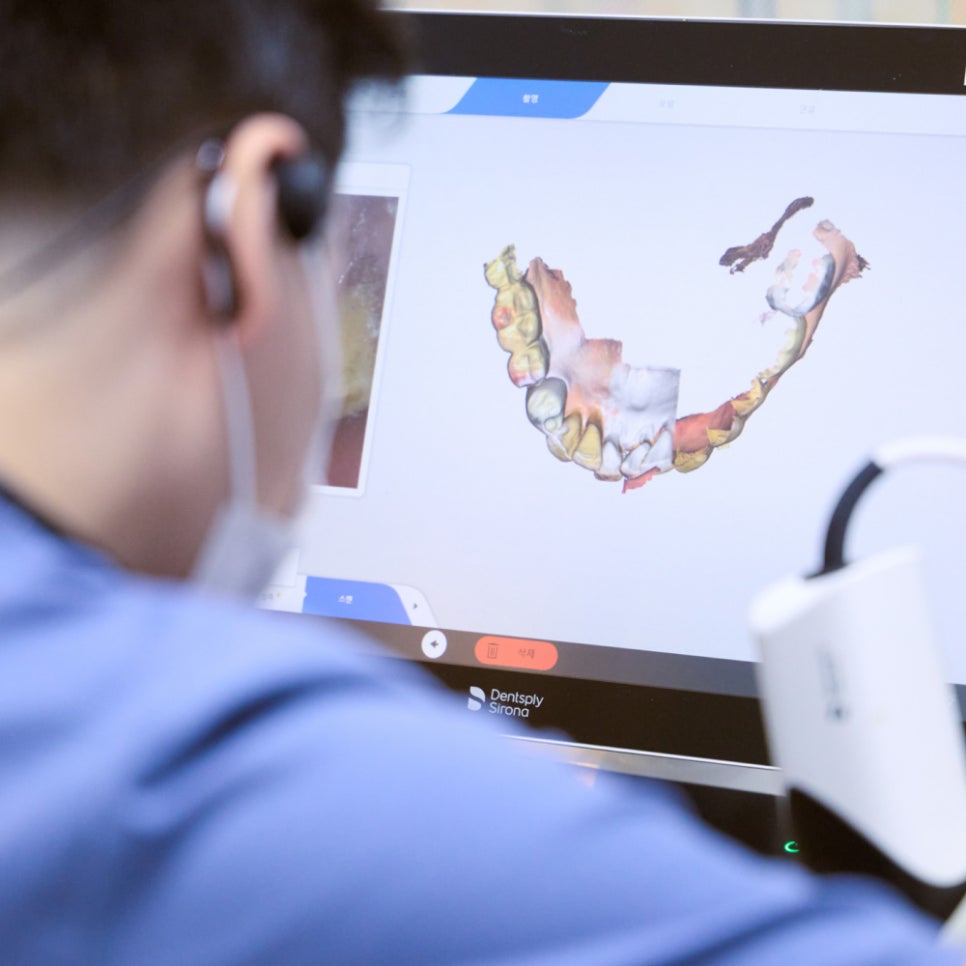 임플란트 이물감, 원인은 미세한 차이? 딱 맞는 보철물, 하루플란트에서 입 안 이물감 해결하기 관련 이미지 6