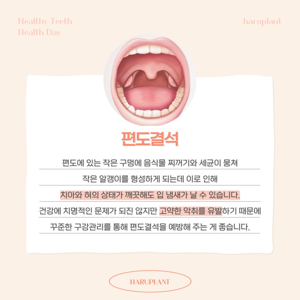 강남역 하루플란트치과 양치 후에도 사라지지 않는 입냄새 원인은 관련 이미지 6