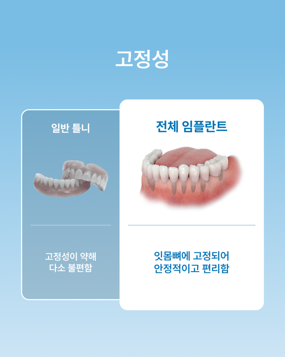 If Dentures Are Uncomfortable, What You Need to Know: The Differences Between Full-Arch Implants and Dentures, as Explained by Haru Plant Dental Clinic in Gangnam image 5