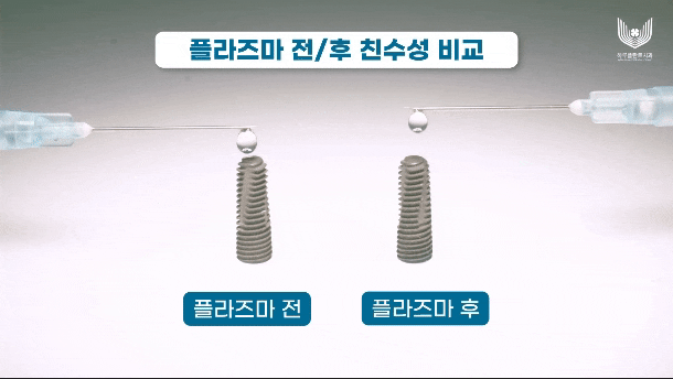 하루플란트치과, 세계 최초 임플란트 표면처리 기술 개발한 플라즈맵과 업무 협약 체결 관련 이미지 4