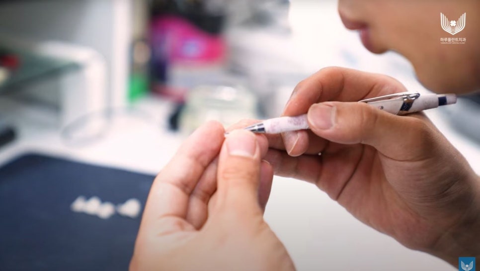 서초구임플란트 자체 기공소 있는 곳에서 해야 하는 이유 관련 이미지 3