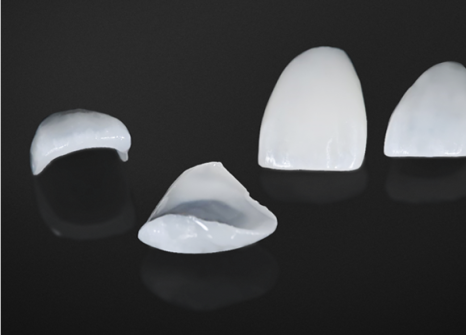 강남역치과 무삭제 라미네이트 총정리(부작용,치료기간,비용) - 하루플란트치과 관련 이미지 6