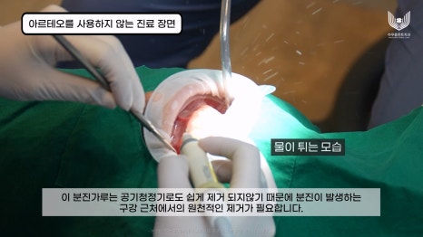 서초구치과 감염예방을 위한 최점단 아르테오 설치 하루플란트치과 관련 이미지 4