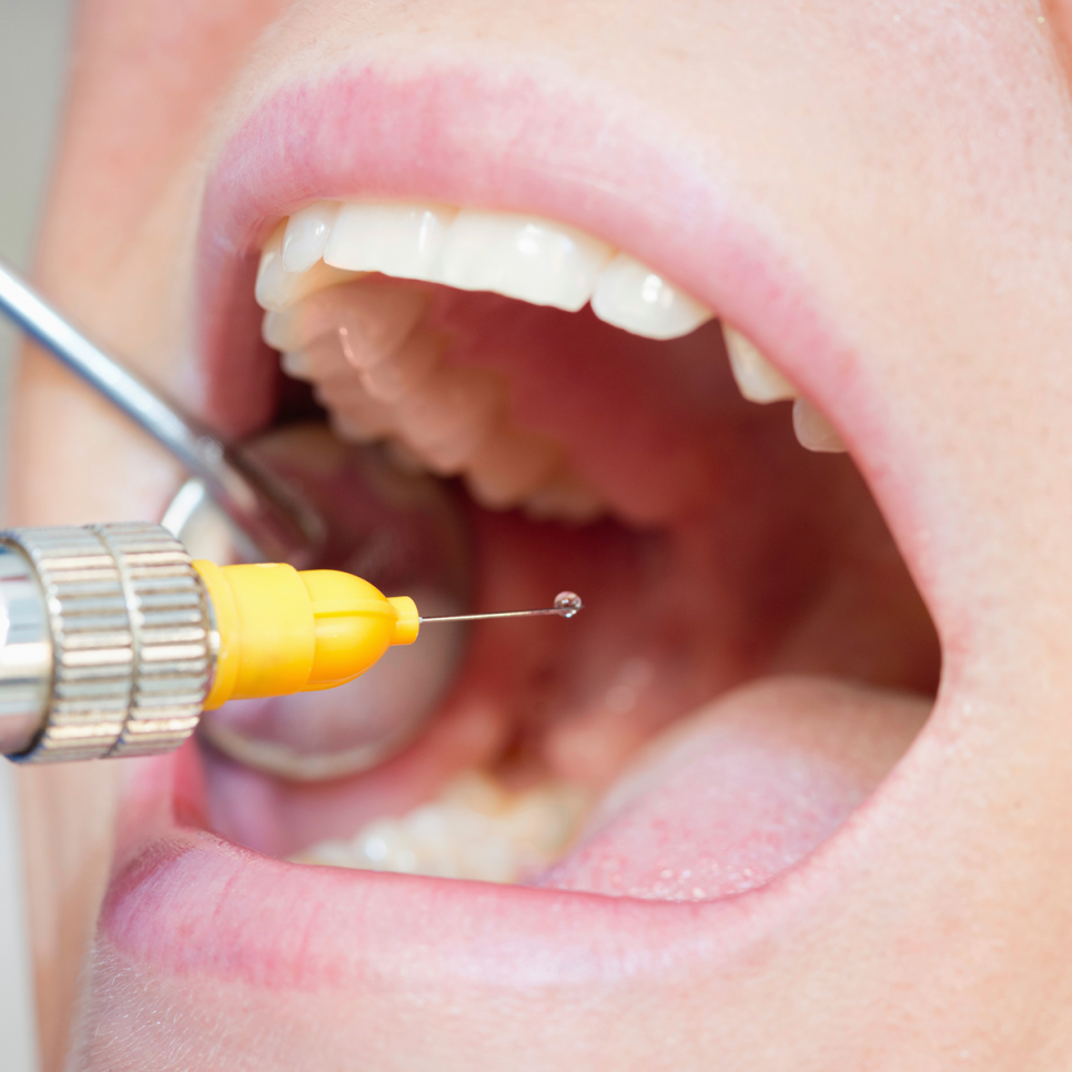 치과 트라우마 때문에 임플란트가 어렵다면? 불안을 잠재워주는 하루플란트의 수면 임플란트! 관련 이미지 1