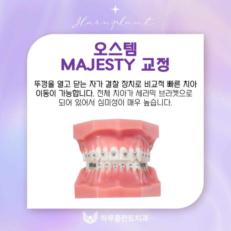 강남역치과 하루플란트치과 치아교정 개인별 맞춤 교정으로 관련 이미지 12