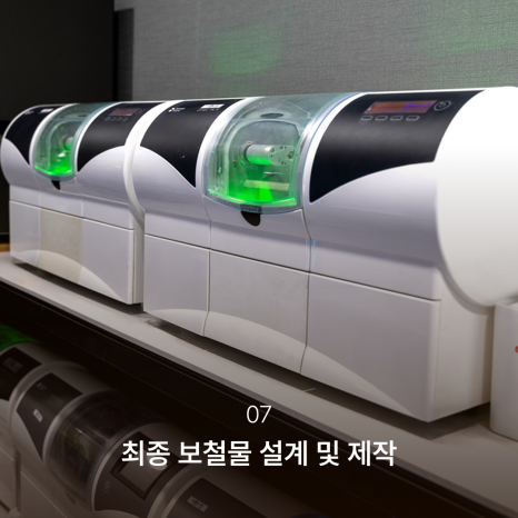 Why the Implant Impression Process Has Changed: The Full Implant Treatment Process at Haru Implant Dental Clinic at Gangnam Station That Makes a Difference in Results image 8